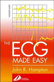 ECG Made Easy