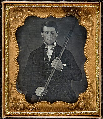 Daguerreotype portrait of Phineas Gage holding the tamping iron that injured him