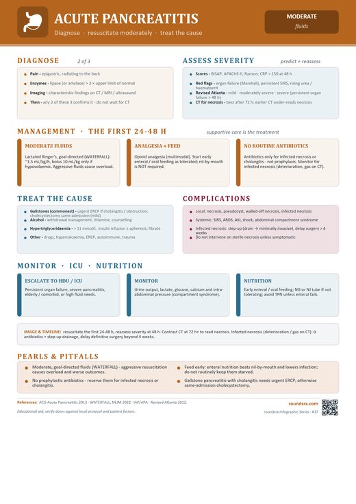 Acute Pancreatitis one-page infographic. Diagnose · resuscitate moderately · treat the cause.