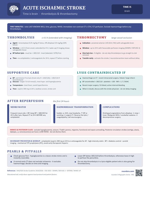 Acute Ischemic Stroke one-page infographic. Time is brain · thrombolysis & thrombectomy.