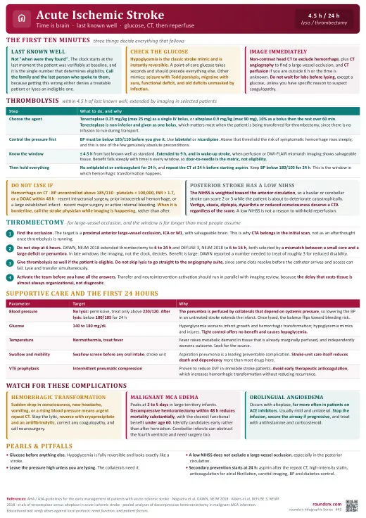 Acute Ischemic Stroke one-page infographic. Time is brain · thrombolysis & thrombectomy. Tap to open the full-size printable PDF.