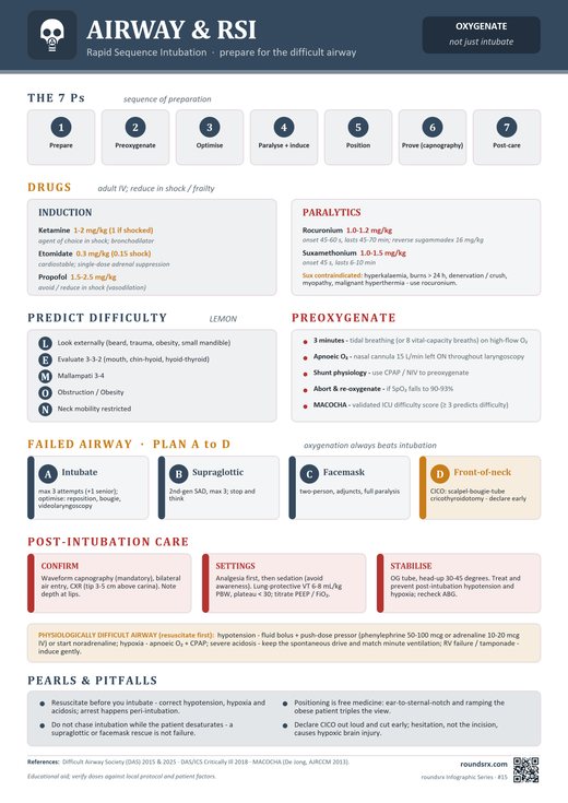 Airway & RSI one-page infographic. Rapid Sequence Intubation · prepare for the difficult airway.