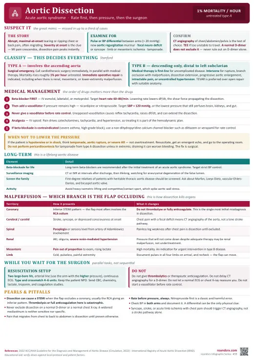 Aortic Dissection one-page infographic. Acute aortic syndrome · rate first, then pressure, then the surgeon. Tap to open the full-size printable PDF.