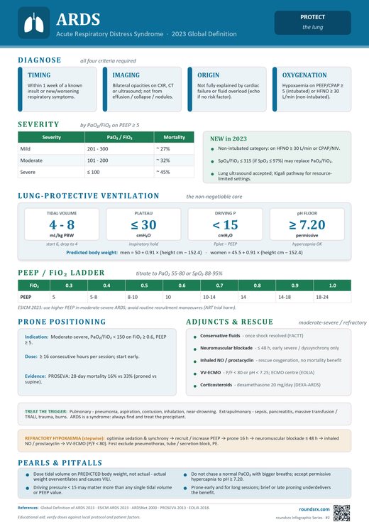 ARDS one-page infographic. Acute Respiratory Distress Syndrome · 2023 Global Definition.
