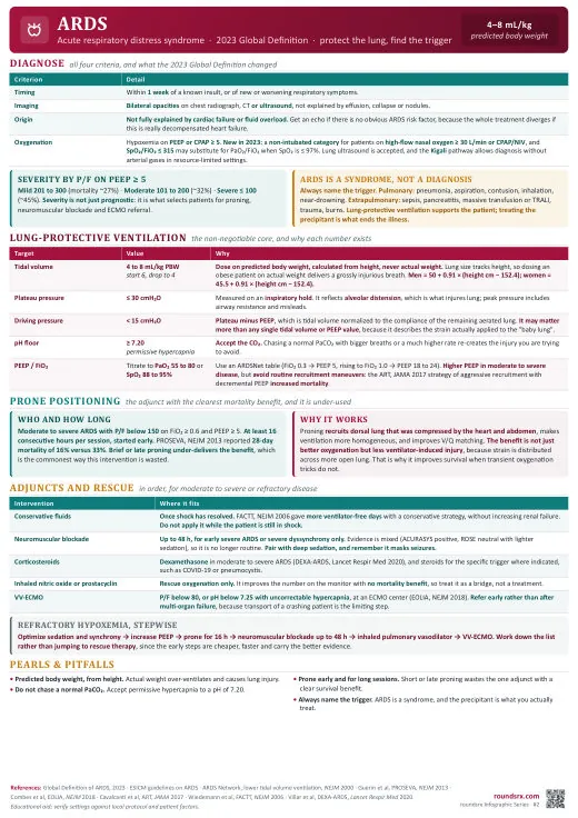 ARDS one-page infographic. Acute Respiratory Distress Syndrome · 2023 Global Definition. Tap to open the full-size printable PDF.