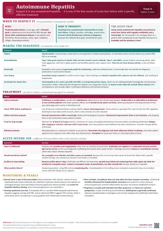 Autoimmune Hepatitis one-page infographic. Diagnosis is a composite · induce with steroids, maintain with azathioprine, and treat long enough.