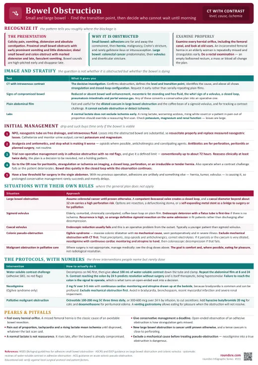 Bowel Obstruction one-page infographic. Small and large bowel · Find the transition point, spot ischemia. Tap to open the full-size printable PDF.