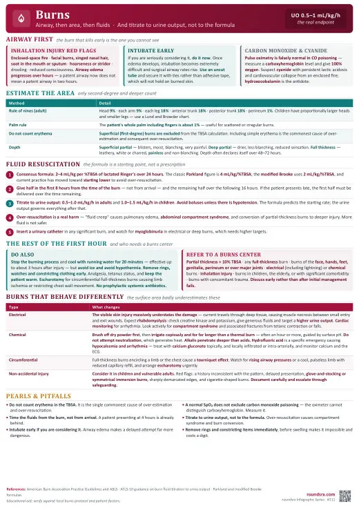 Burns one-page infographic. Airway, area, fluids · titrate to urine output not the formula. Tap to open the full-size printable PDF.