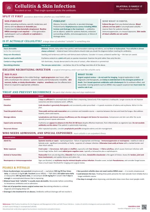 Cellulitis & Skin Infection one-page infographic. Purulent or not · bilateral is rarely cellulitis. Tap to open the full-size printable PDF.