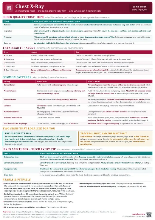 Chest X-Ray one-page infographic. A systematic read · what the findings mean. Tap to open the full-size printable PDF.