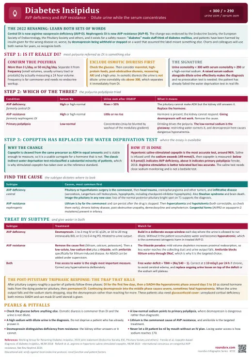 Diabetes Insipidus one-page infographic. AVP deficiency vs AVP resistance · copeptin has replaced water deprivation.
