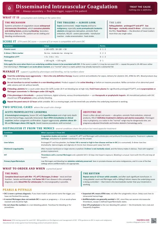 Disseminated Intravascular Coagulation one-page infographic. Always secondary · find the trigger, support the patient. Tap to open the full-size printable PDF.
