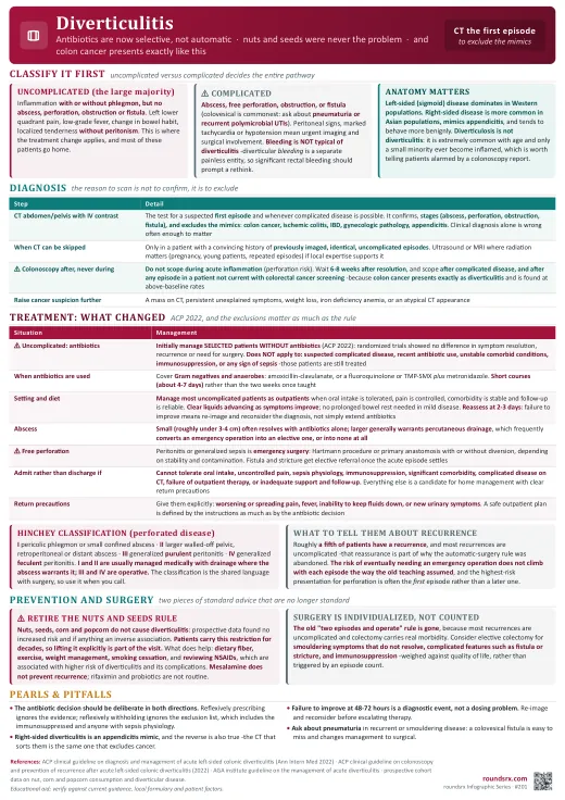 Diverticulitis one-page infographic. Antibiotics are now selective · CT excludes the mimics · and colon cancer presents exactly like this. Tap to open the full-size printable PDF.