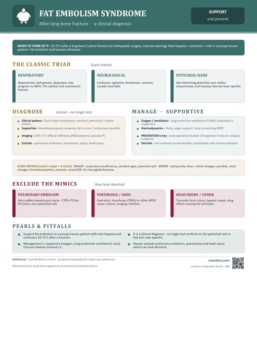 Fat Embolism Syndrome one-page infographic. After long-bone fracture · a clinical diagnosis.