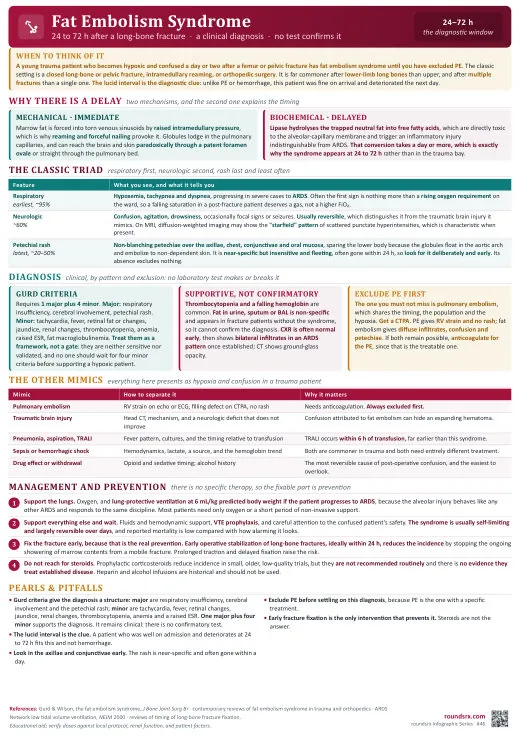 Fat Embolism Syndrome one-page infographic. After long-bone fracture · a clinical diagnosis.
