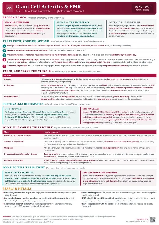 Giant Cell Arteritis & PMR one-page infographic. Steroid first, biopsy after · sight lost is not recovered. Tap to open the full-size printable PDF.