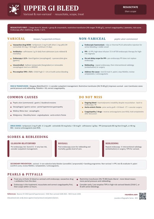 Upper GI Bleed one-page infographic. Variceal & non-variceal · resuscitate, scope, treat.