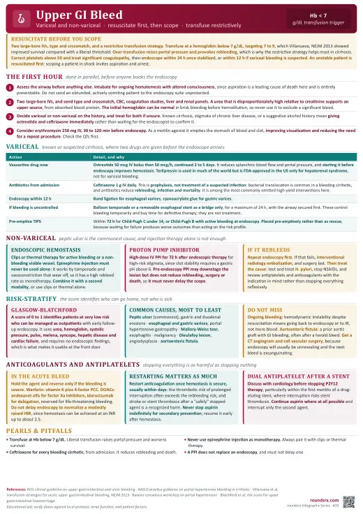 Upper GI Bleed one-page infographic. Variceal & non-variceal · resuscitate, scope, treat. Tap to open the full-size printable PDF.
