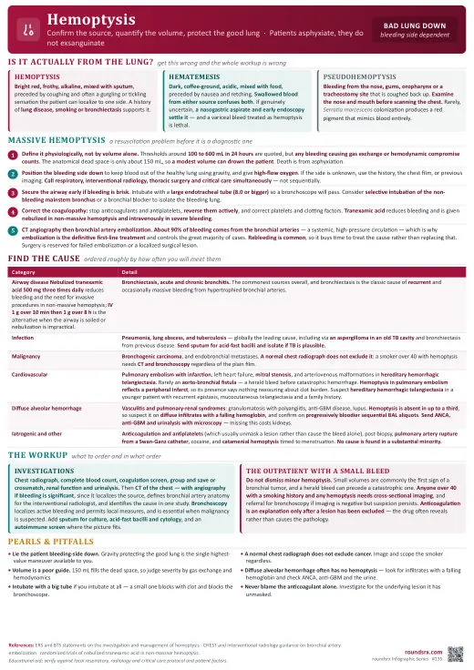 Hemoptysis one-page infographic. Bad lung down · Patients asphyxiate, not exsanguinate. Tap to open the full-size printable PDF.
