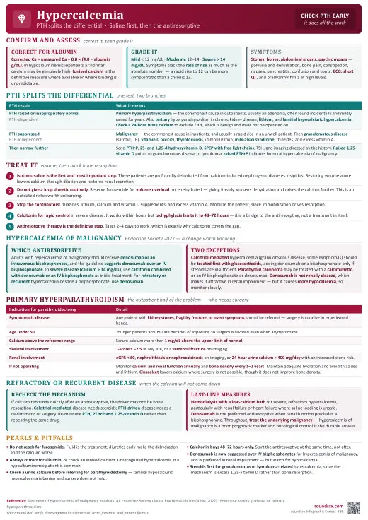 Hypercalcemia one-page infographic. PTH splits the differential · saline first, then the antiresorptive. Tap to open the full-size printable PDF.