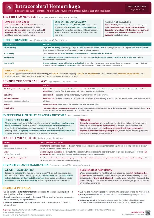Intracerebral Hemorrhage one-page infographic. Target SBP 140 · reverse the anticoagulant, stop the expansion. Tap to open the full-size printable PDF.