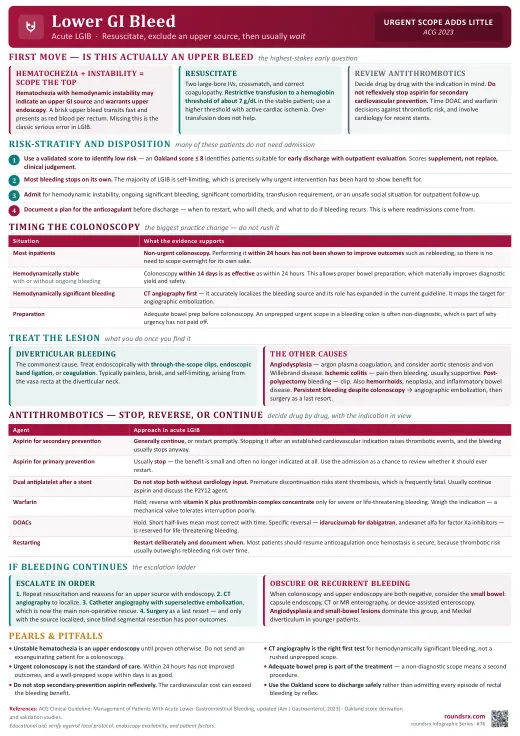 Lower GI Bleed one-page infographic. Exclude an upper source, then usually wait to scope. Tap to open the full-size printable PDF.