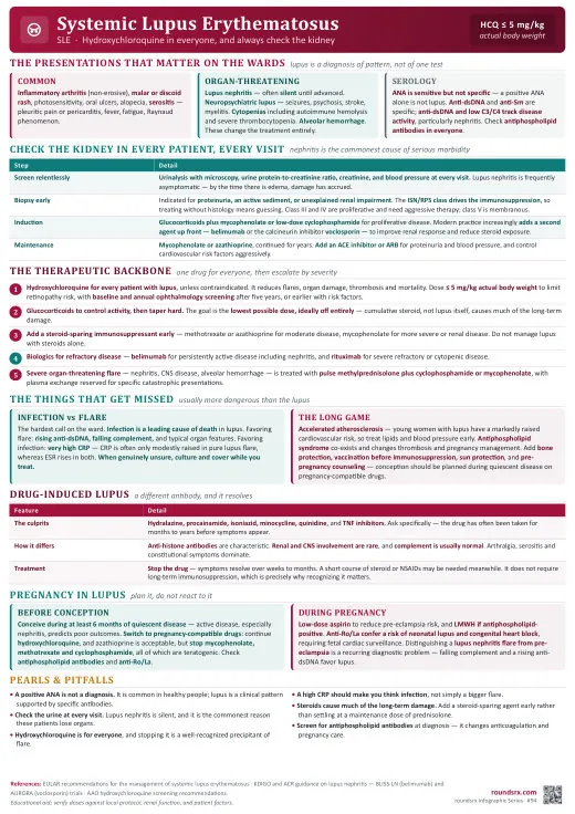 Systemic Lupus Erythematosus one-page infographic. Hydroxychloroquine in everyone · always check the kidney. Tap to open the full-size printable PDF.