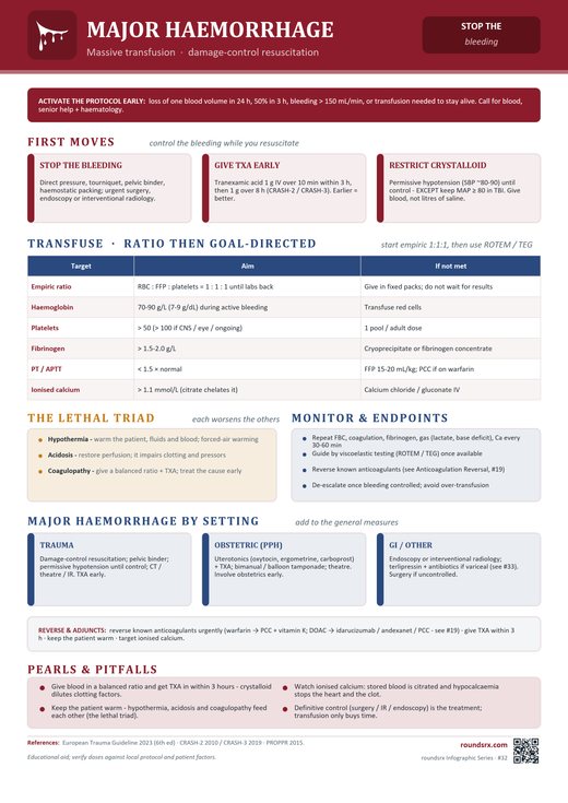 Major Hemorrhage one-page infographic. Massive transfusion · damage-control resuscitation.