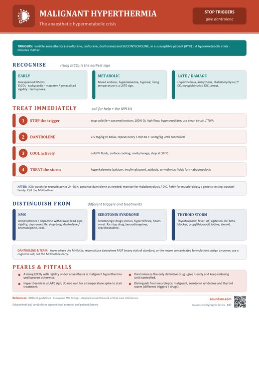Malignant Hyperthermia one-page infographic. The anesthetic hypermetabolic crisis.