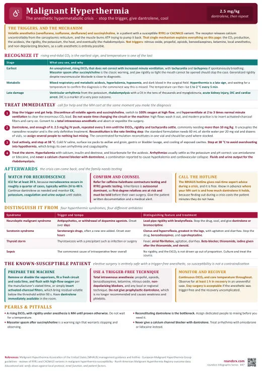 Malignant Hyperthermia one-page infographic. The anesthetic hypermetabolic crisis.