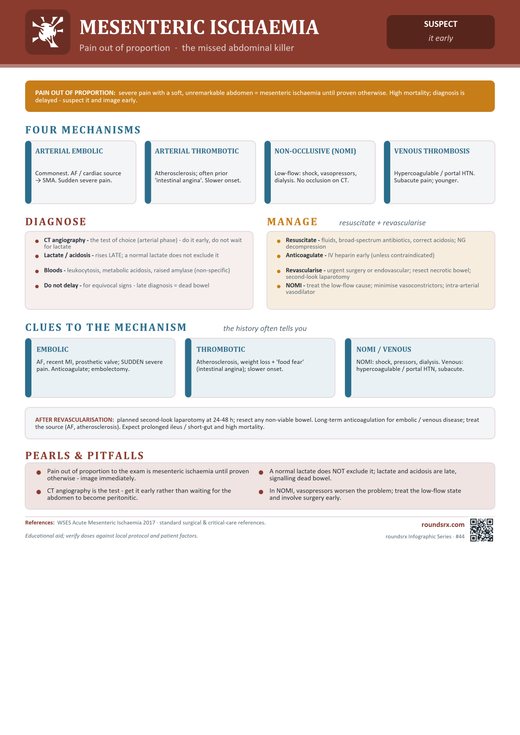 Mesenteric Ischemia one-page infographic. Pain out of proportion · the missed abdominal killer.