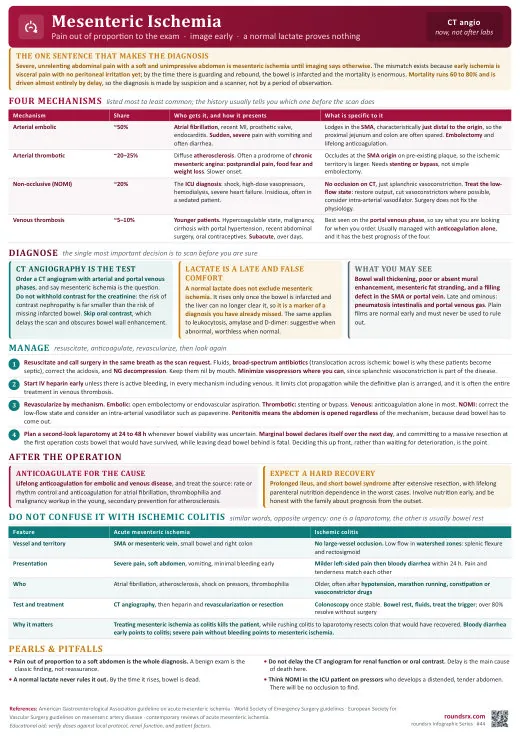 Mesenteric Ischemia one-page infographic. Pain out of proportion · the missed abdominal killer. Tap to open the full-size printable PDF.