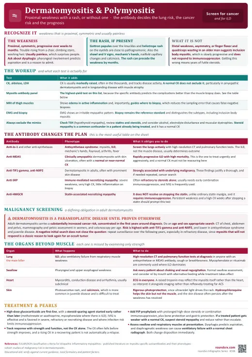 Dermatomyositis & Polymyositis one-page infographic. The antibody decides the lung risk, the cancer risk and the prognosis. Tap to open the full-size printable PDF.
