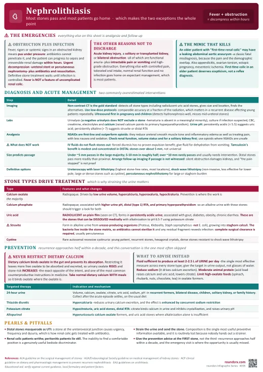 Nephrolithiasis one-page infographic. Obstruction plus infection is the emergency · NSAIDs beat opioids · and never restrict dietary calcium. Tap to open the full-size printable PDF.