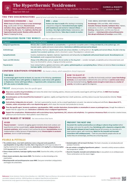 The Hyperthermic Toxidromes one-page infographic. NMS vs serotonin syndrome · Clonus versus lead-pipe rigidity.