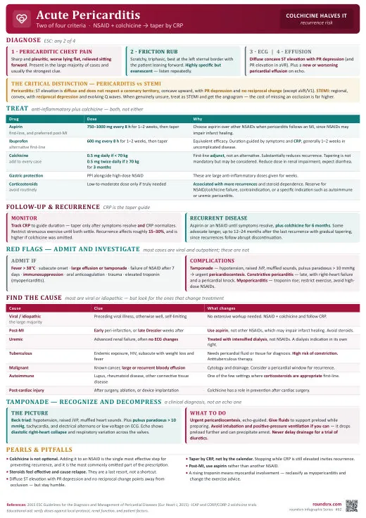 Acute Pericarditis one-page infographic. Two of four criteria · NSAID + colchicine, taper by CRP. Tap to open the full-size printable PDF.