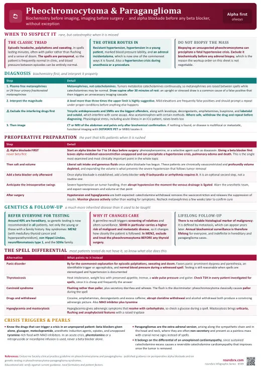 Pheochromocytoma & Paraganglioma one-page infographic. Metanephrines before imaging · alpha blockade before any beta blocker, without exception.