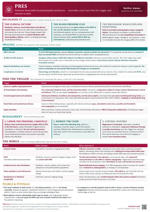 PRES one-page infographic. Posterior reversible encephalopathy · neither always posterior nor always reversible.