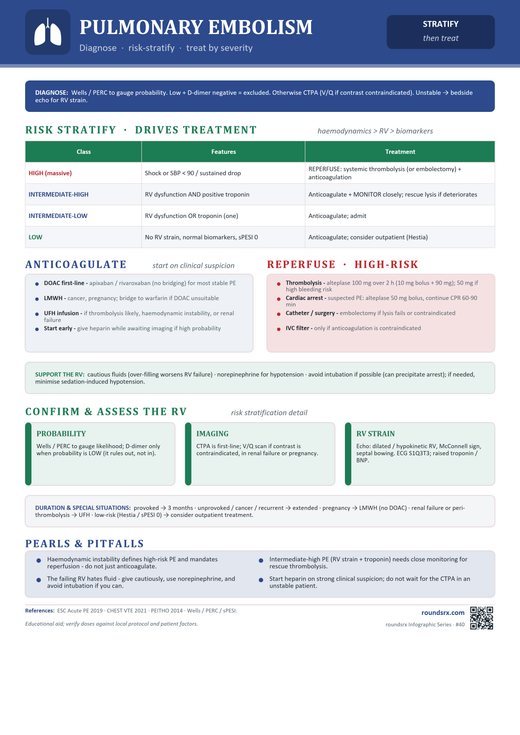 Pulmonary Embolism one-page infographic. Diagnose · risk-stratify · treat by severity.