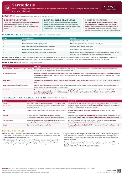 Sarcoidosis one-page infographic. A diagnosis of exclusion · treat organ dysfunction not the radiograph, and screen the heart in everyone.