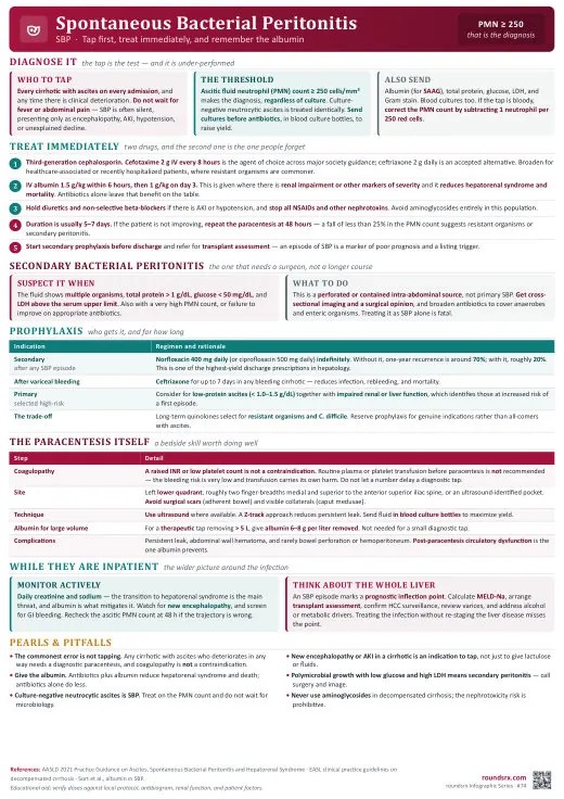 Spontaneous Bacterial Peritonitis one-page infographic. Tap first, treat immediately, remember the albumin. Tap to open the full-size printable PDF.