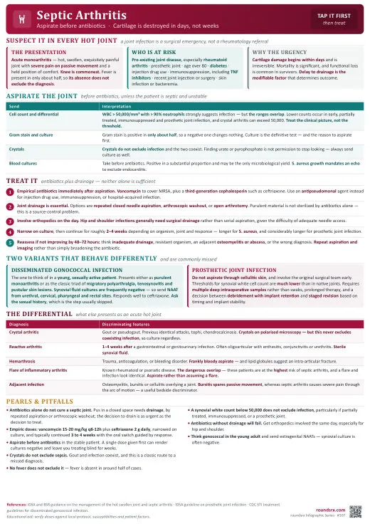 Septic Arthritis one-page infographic. Aspirate before antibiotics · cartilage dies in days.