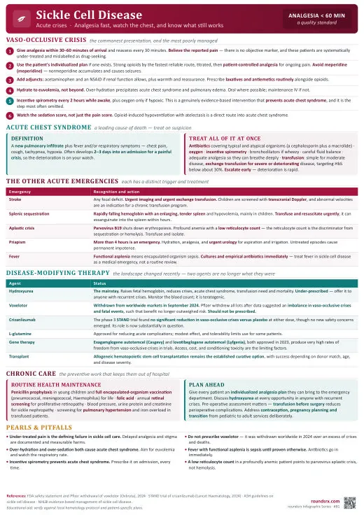 Sickle Cell Disease one-page infographic. Analgesia fast, watch the chest, know what still works. Tap to open the full-size printable PDF.
