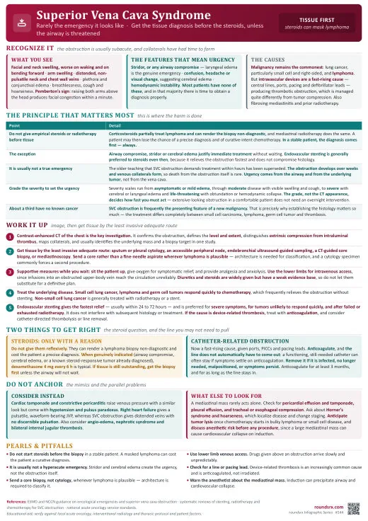 Superior Vena Cava Syndrome one-page infographic. Tissue diagnosis before steroids · Stent for severe symptoms. Tap to open the full-size printable PDF.