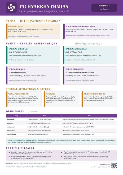 Tachyarrhythmias one-page infographic. The tachycardia-with-a-pulse algorithm · rate > 150.